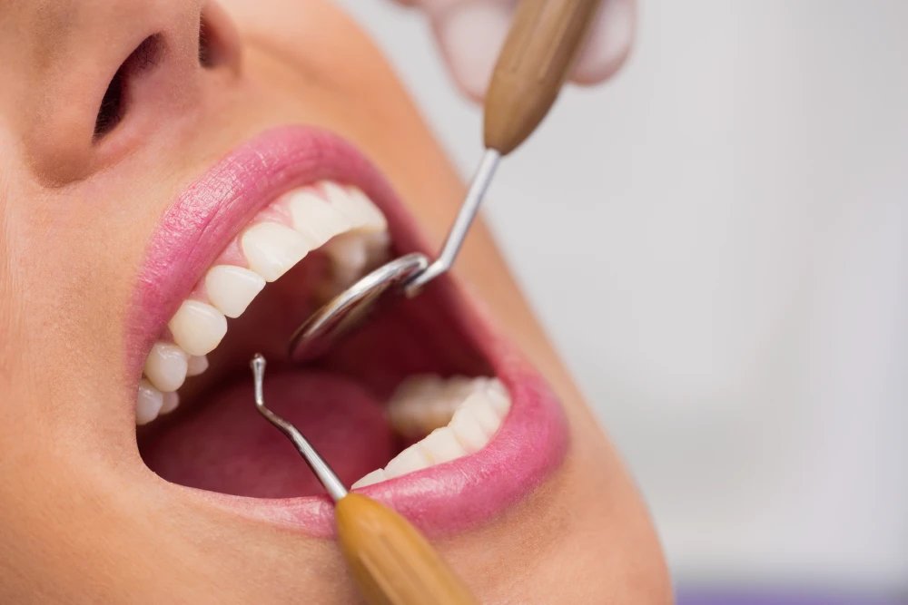 Implantes dentários: conheça os benefícios do tratamento
