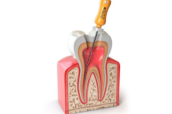 endodontia-1