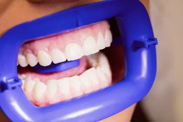 female_patient_receiving_dental_treatment_1